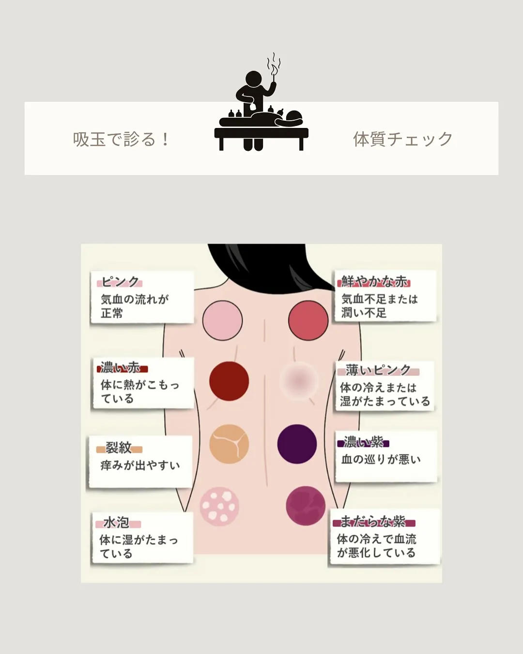 新しくなって人気上昇中！🔥の『吸玉療法』