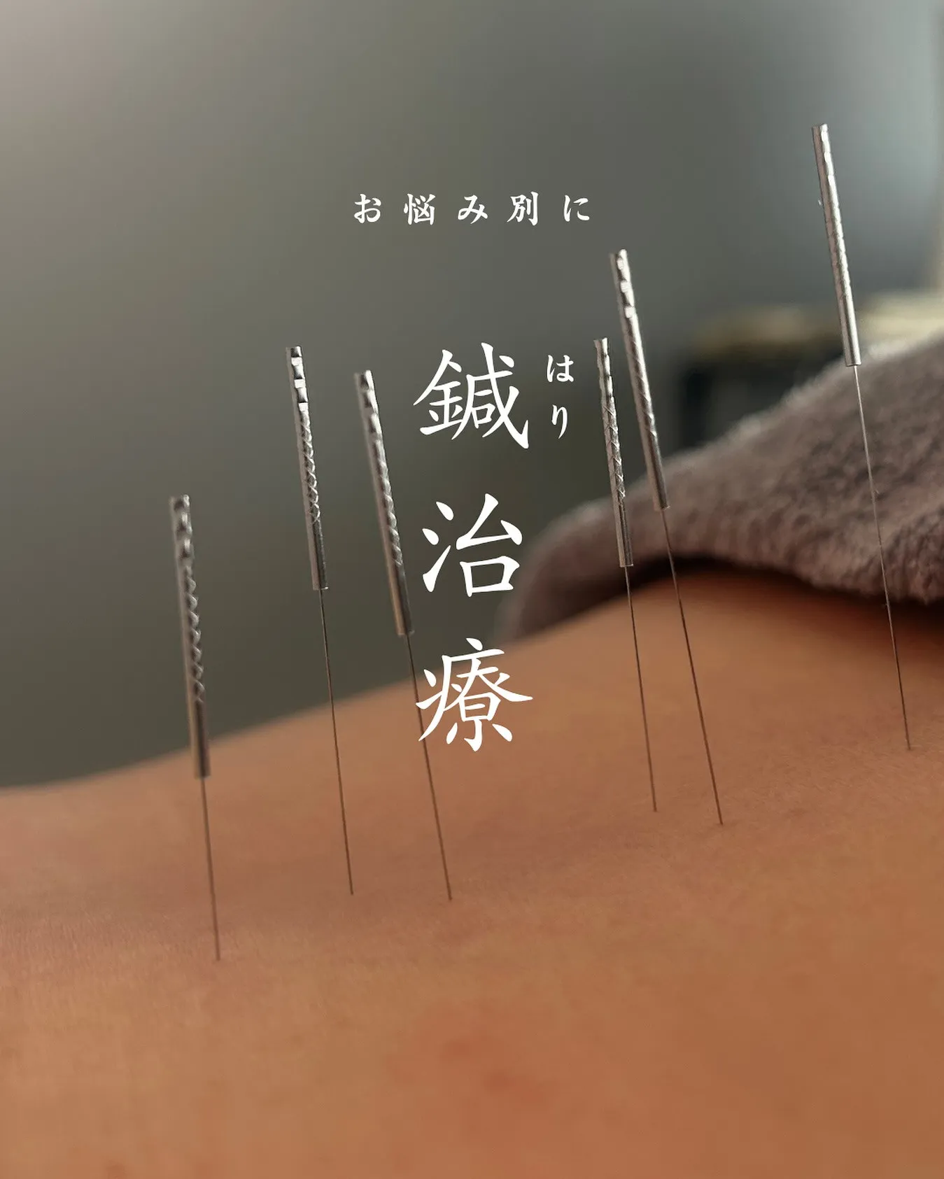 🏷｜お悩み別でセレクト \鍼治療一覧/