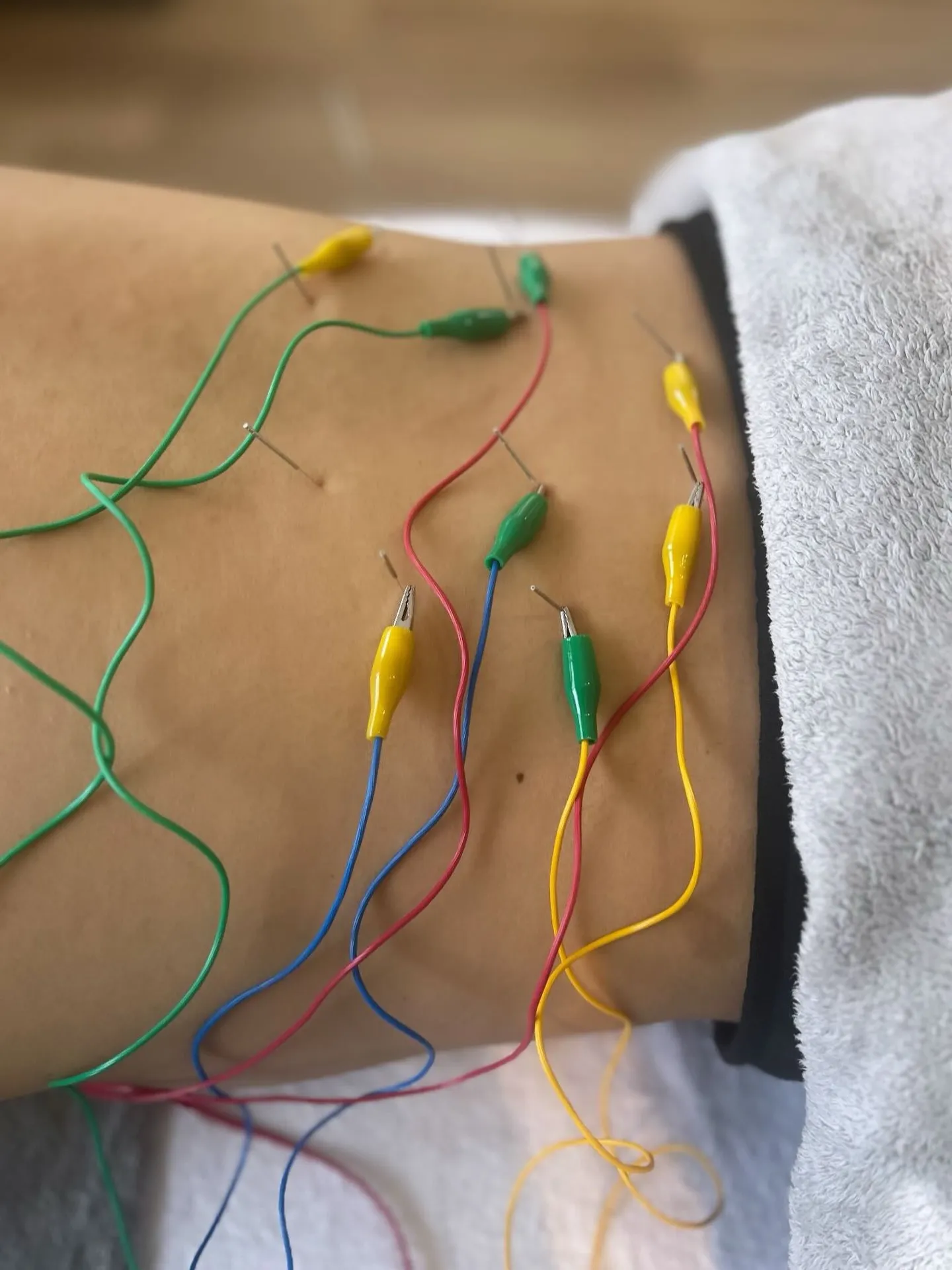 ボディセレクト100分|鍼治療・整体・吸玉・デコルテホットス...