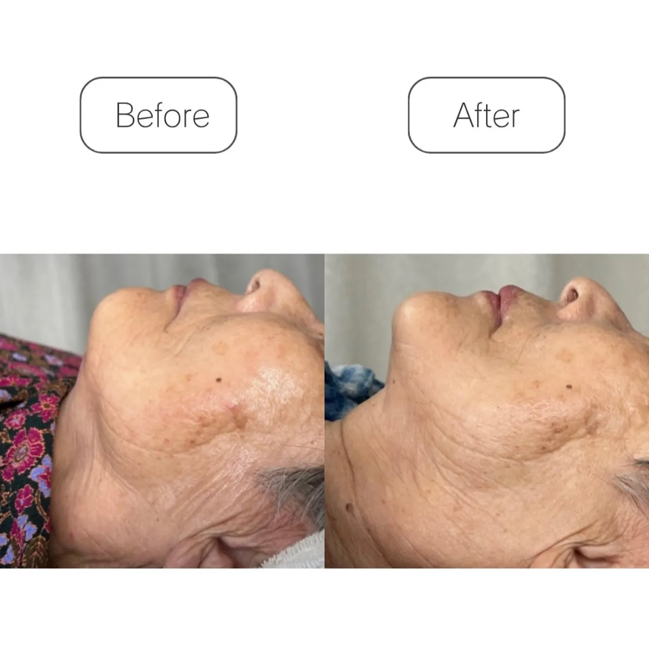 美容医療の前にオーガニックエステの選択を🥣