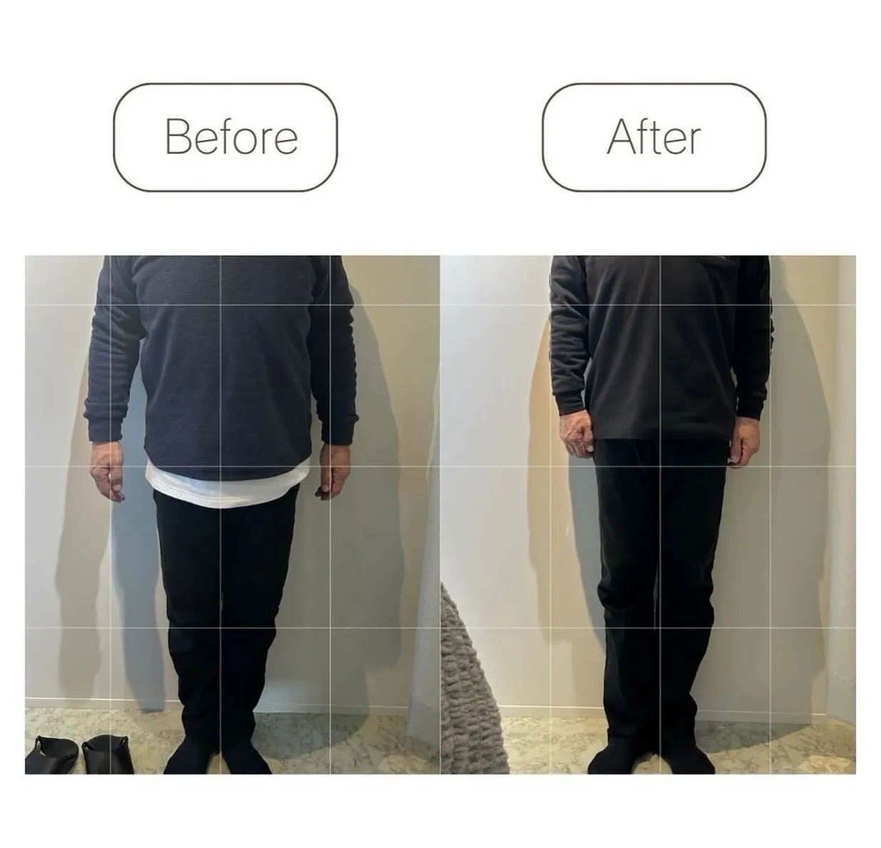 ╲BeforeAfter集╱