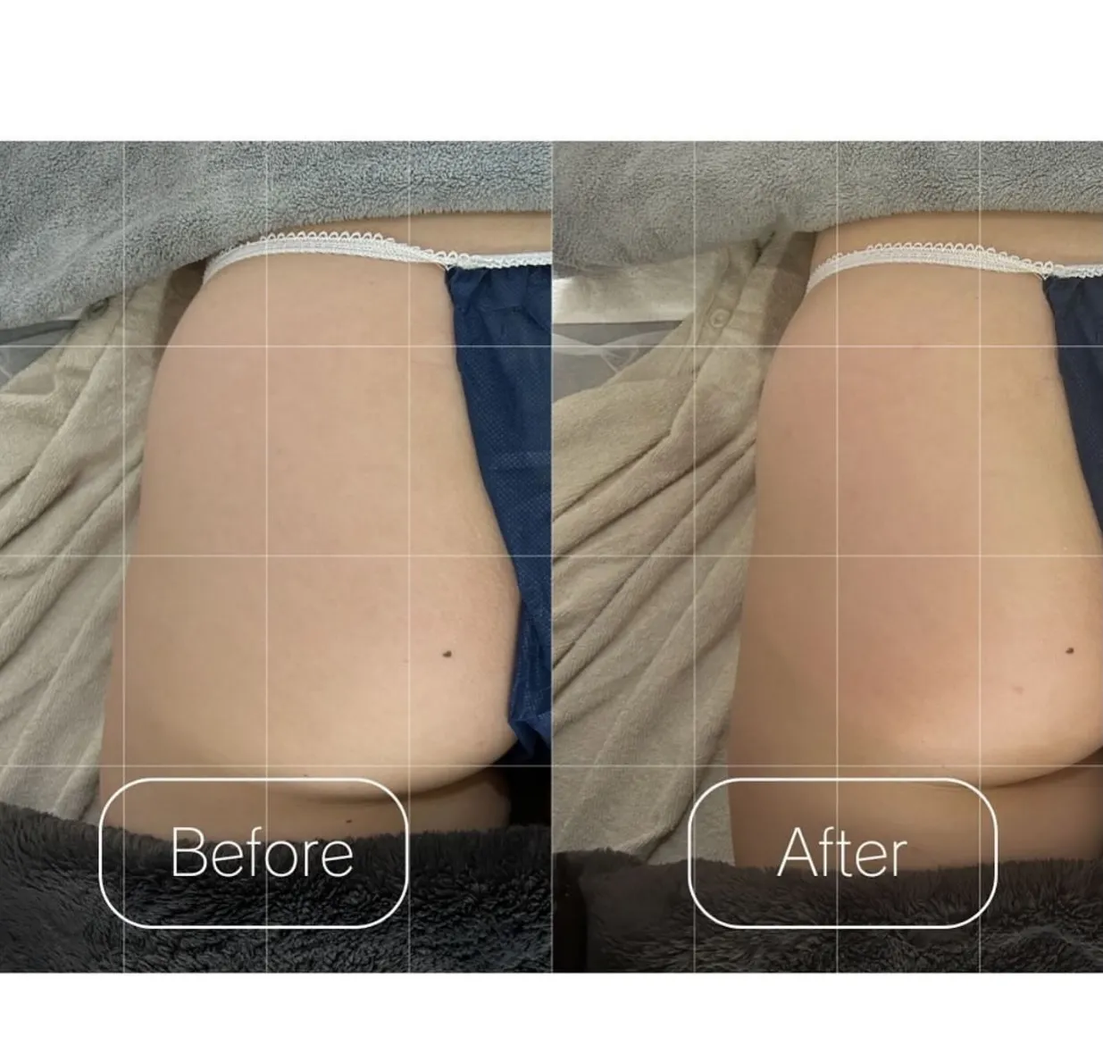 ╲BeforeAfter集╱