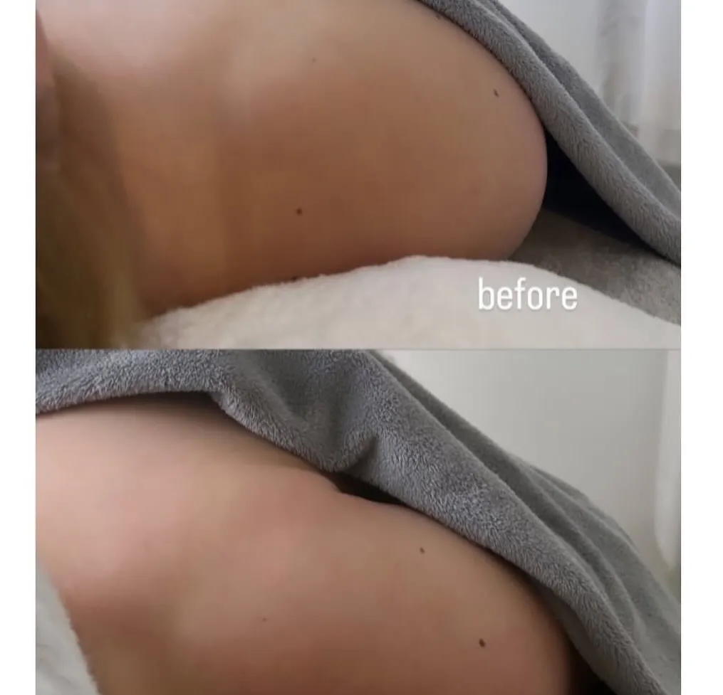 ╲BeforeAfter集╱