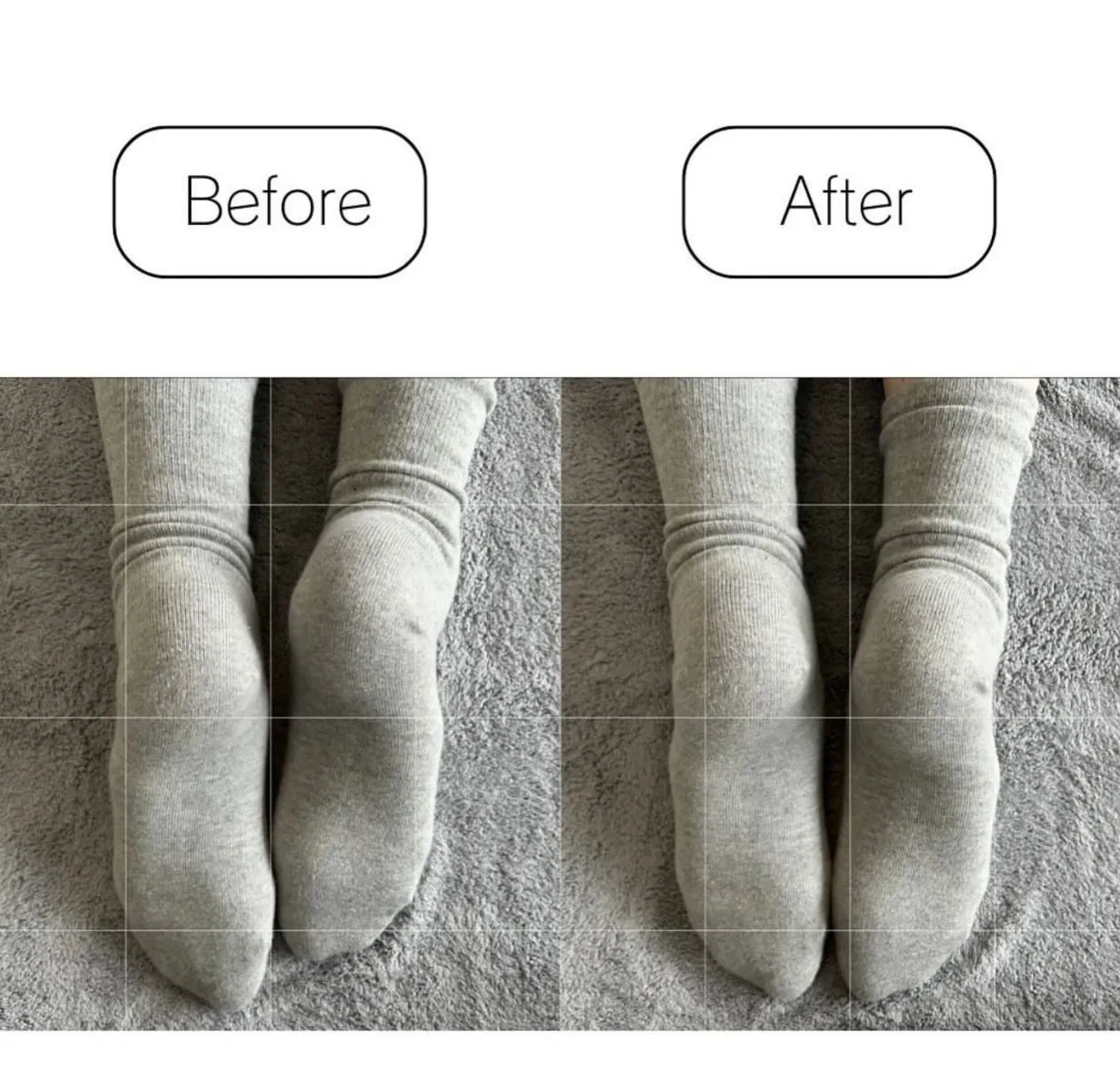 ╲BeforeAfter集╱
