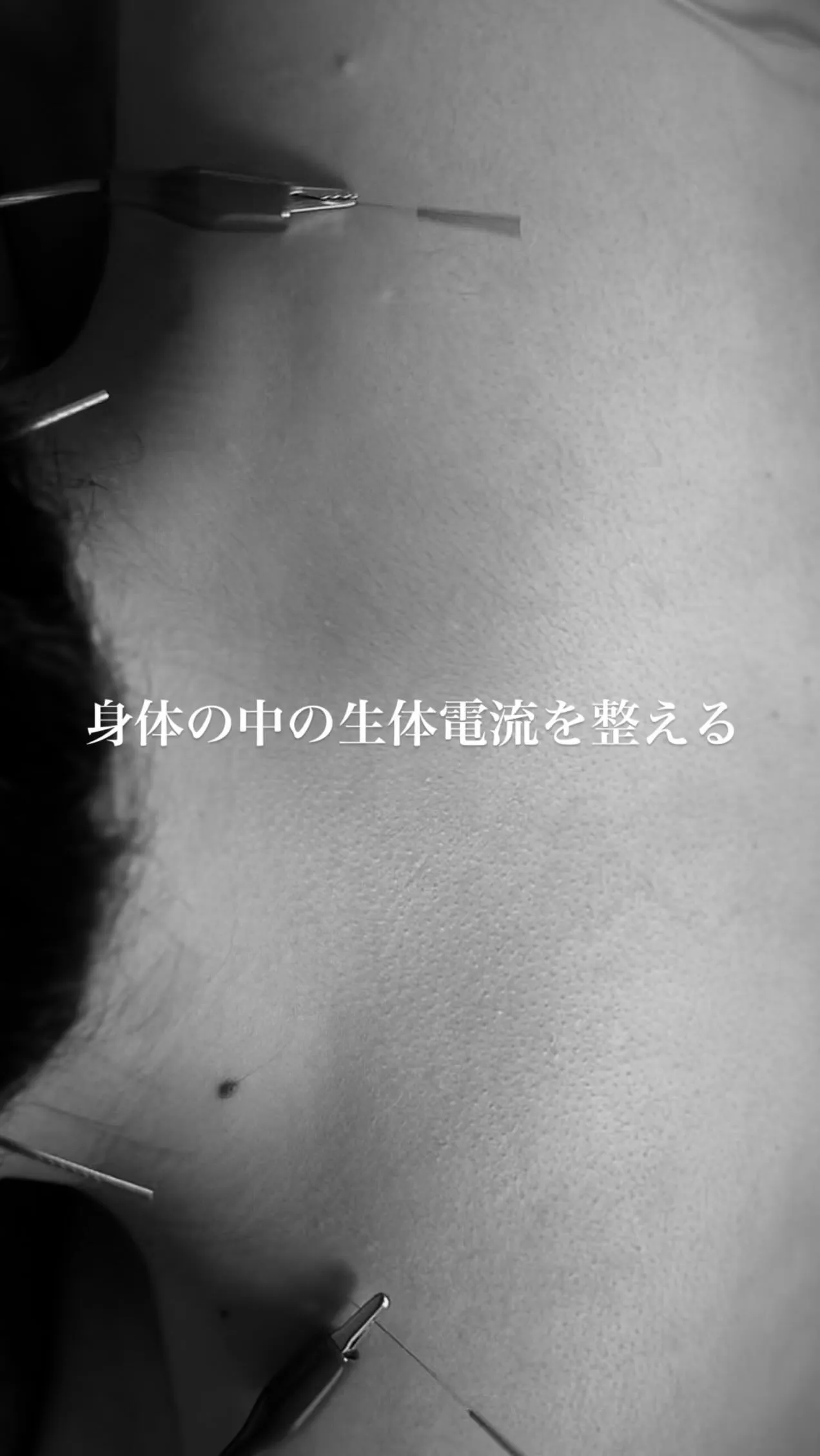 身体の中の生体電流を整えてくれる微弱電流