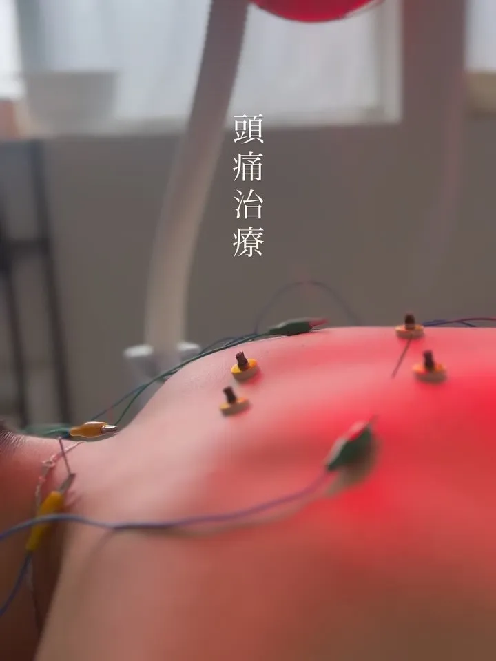 【つらい慢性頭痛に】